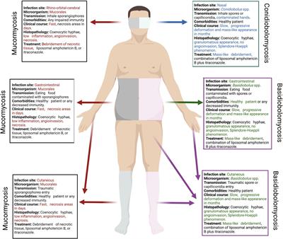 An old confusion: Entomophthoromycosis versus mucormycosis and their main differences